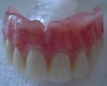/album/estheticproteseodontologica/dentes-299-jpg/